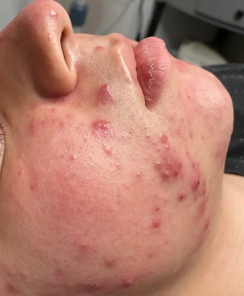 Procell pg. before